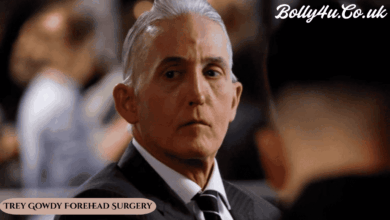 Trey Gowdy Forehead Surgery